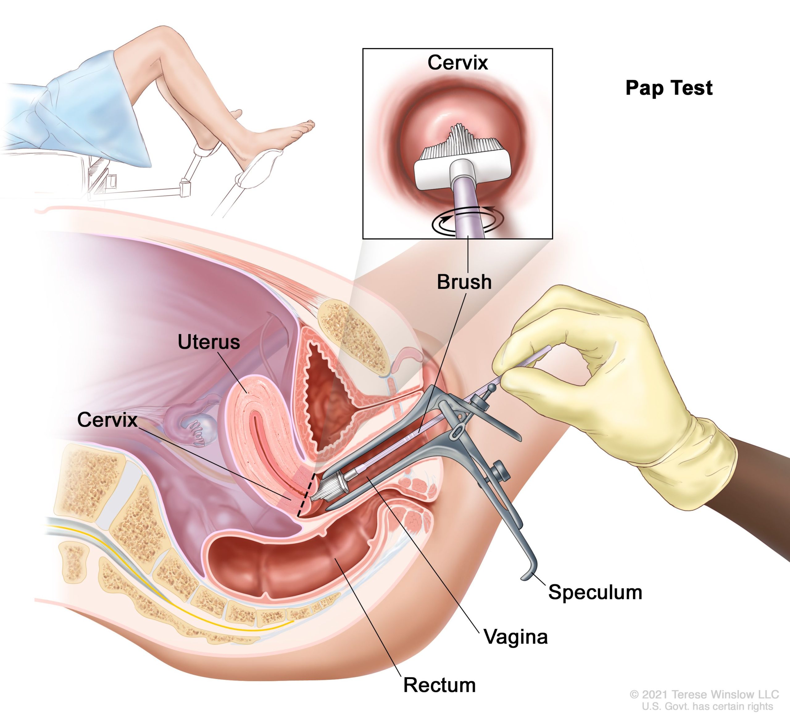Nurse performing a cervical screening test at Gosford Doctors