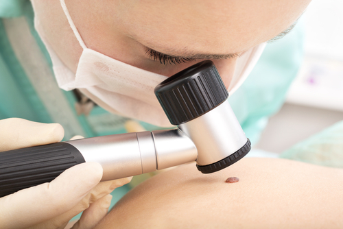 Clinician performing a skin cancer check at Gosford Doctors